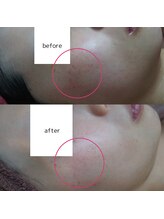 アップルミント/