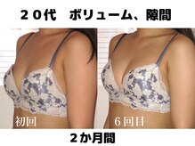 バストサロン メルベイユ(Merveile)/ボリュームUP、ブラの隙間埋まる