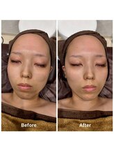 ミル(milu)/くせになる小顔フェイシャル