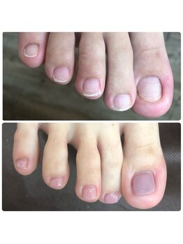 ブルームーンネイルズ(BLOOMOON.nails)/フットのお悩みもご相談ください