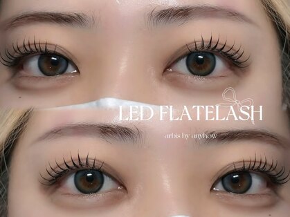 アルビス バイ エニーハウ(Arbis by anyhow)の写真