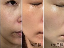 ミルジュ(MiLuJu)/レストセルトリートメント