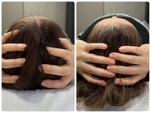 サロンド ソラ(Salon de SoLA)/人気！メイクオフ不要小顔調整！