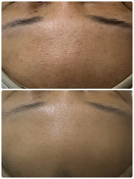 サンテ(Sante)/ビフォーアフター