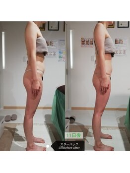 RiとBiのたまご/（BODY）　最新機セルケア