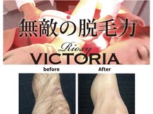サイエス(SAIs)の雰囲気（男女問わずどこよりも早い圧倒的効果の光＆ワックス脱毛★）