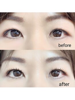 ヴィーナス 船橋駅前店(VENUS)/リフティングカール