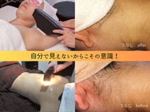 ノノケケ(NONOKEKE)の雰囲気（脱毛で美肌に！旅行やファッションも気兼ねなく楽しみたい方必見）