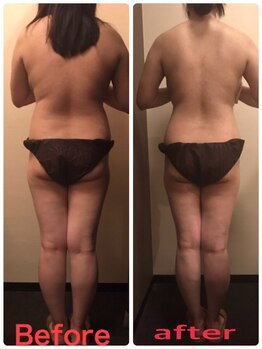 ルアン 八千代台店(Ruang)/お客様ビフォーアフター