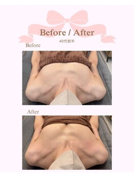 ロココ 安城店(Rococo)/バストアップ症例