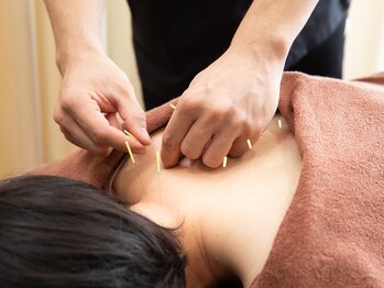 ひばり鍼灸整骨院 整体院 相模原店/身体のお悩みご相談ください!