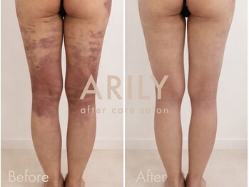 アリリィ(ARILY)/ARILY after care salon