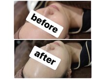 アリュールビューティー 下高井戸店(ALLURE BEAUTY)の雰囲気（人気NO1 韓国肌管理【セラピール】1回で劇的な赤み改善！ツヤ肌）