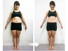 松山美容整体院/（30歳代）施術例