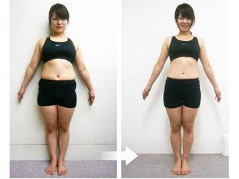 松山美容整体院/（30歳代）施術例