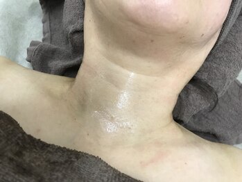 ナノハナ/鹿沼市全身脱毛の美容室ナノハナ