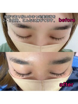 サロンインプルーヴ(Salon improve)/当店取扱中☆まつ毛美容液