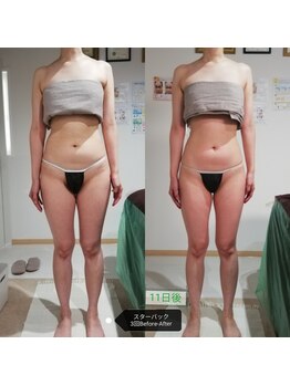 RiとBiのたまご/（BODY）最新機セルケア