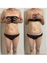 ミュウ(miuex)/お腹周りスッキリ！！