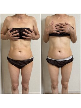 ミュウ(miuex)/お腹周りスッキリ！！