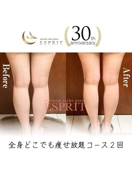 エスプリ 銀座店/銀座痩身・痩せる・ダイエット