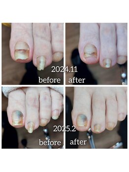 爪切り屋 足楽/