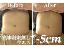 サロン アイリス(salon iRiS)の雰囲気（業界初の美容痩身機器を使用し短時間施術で目に見える効果を実感）