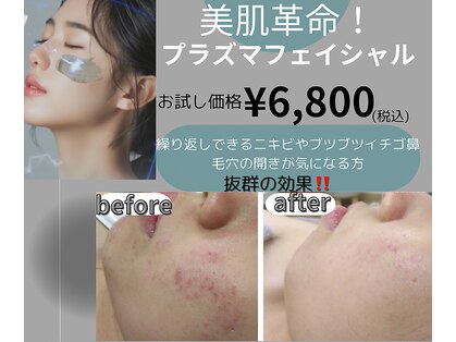 グロワール(gloire)の写真