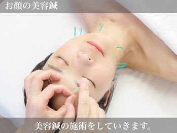 ルチア(Lucia)/お顔の美容鍼