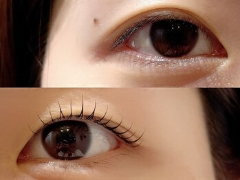 ニコット(Nicotto)/左右差ある目元もお任せください