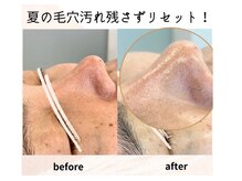 ギフト(gift)の雰囲気(夏のダメージをクリアに!初回から驚きのトーンアップ艶肌に★)