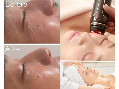 パールムーン(pearl moon)の写真