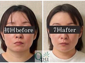 キュープ 鹿児島伊集院店(Qpu)/