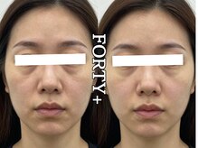 フォーティープラス(FORTY+)/施術事例
