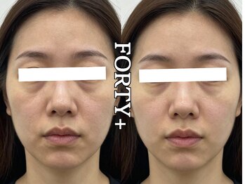 フォーティープラス(FORTY+)/施術事例