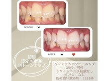 スリール(sourire)の雰囲気（効果に自信があるから症例写真は全て本物&無加工！）