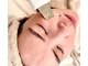 アドネ(Adone)の写真/超音波ケアで化粧水の浸透率抜群★触りたくなる極上の《つるつる赤ちゃん肌》へ変化♪