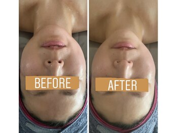 小顔コルギサロン シー(She)/【コルギ】1度の変化!