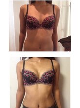 美人バスト 豊橋店/バストアップ症例【バストケア】