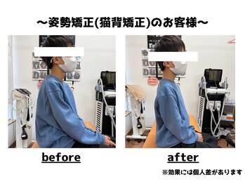 トータルビューティーみつとも/姿勢矯正/猫背矯正