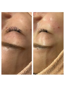 アルベリー 三軒茶屋(R'berry)/つやピカ人気のフェイスワックス