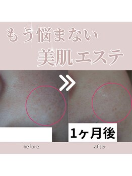 アップルミント/