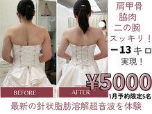 ウィズマツオカ 光の森店