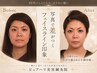 頭痛・眼精疲労改善の集中鍼 60分　¥5980