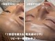 ルミグロウ(Lumi.Glow)の写真