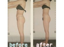 ビューティースパ/反り腰悩み.ポッコリお腹解消♪