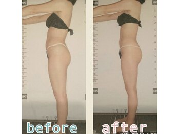 ビューティースパ/反り腰悩み.ポッコリお腹解消♪