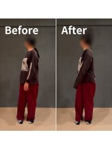 パレット(PALETTE)/【施術風景】鍼灸/ストレッチ