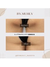 サボラミ(sabor A Mi)/気になる黒ずみ【BY.MUHLY】