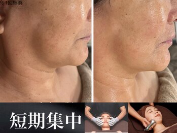 アクアリジェ/レモンボトルグロッティ導入1回